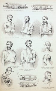 临时治疗骨折，c.1890 作者 英语学校