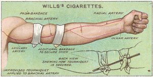 Tourniquet，1913年来自Willss Cigarettes卡的First Aid系列的11号 作者 英语学校