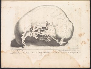 圣鲁莫尔德斯的头骨，1825 年
圣人鲁莫尔德斯盆骨的图像，如圣物柜中的圣人鲁莫尔德斯盆骨（标题在实物上）