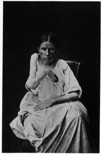 Photograph of a patient suffering from hemiplegic epilepsy, -in “” photographic iconography of the Salpetrière, Bourneville and P. Regnard, Paris 作者 法国摄影师