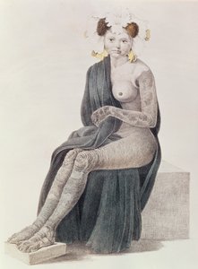 先天性鱼鳞病，来自GM Olbers的一本书，1830年 作者 法语学校