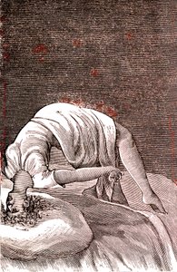 癔病，因强烈焦虑而导致的精神和神经失调。1887年（雕刻） 作者 法语学校