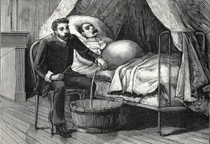 晚期肝硬化患者，医生进行穿刺（雕刻）1888 作者 法语学校