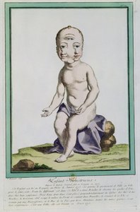 1775年，来自巴黎的&39;Les Ecarts de la Nature&39;的变形头的孩子