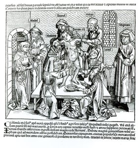 割礼，来自Hartmann Schedel的“Liber Chronicarum”（1440-1514） 作者 德国学校
