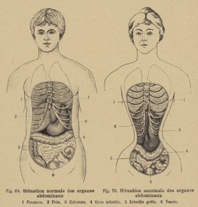男女腹部内脏正常情况 作者 德国学校