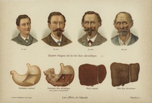 The effects of alcohol abuse (colour litho) 作者 德国学校