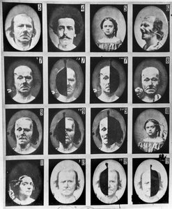 来自Duchenne de Boulogne的“人类生理学的Mecanism或激情的电生理学分析”的物理学研究，于1876年出版，巴黎