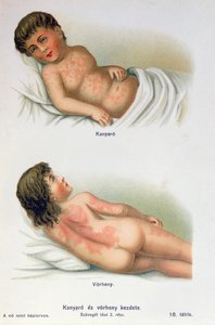 麻疹和猩红热，来自家庭医学书籍，c.1900 作者 匈牙利学校