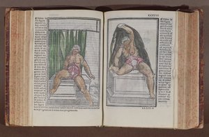 女性解剖，从历史，用最慷慨增加的解剖mundini，发表在博洛尼亚byJacopo Berengarlo DA卡尔皮（c.1460-c.1530），1521（彩色版画） 作者 意大利学校