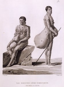 北马里亚纳群岛：两名患有肺结核的男子，来自1875年出版的“资产阶级18世纪20世纪18世纪20世纪18世纪20世纪20世纪20世纪20世纪20年代的护卫舰世界之旅”，1825年出版
