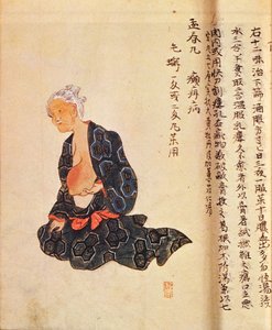 第一次手术治疗乳腺癌是由Seishu Hanaoka（1760-1836）在1804年在全身麻醉下进行的 作者 日本学校