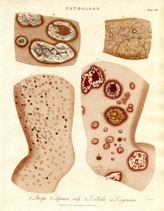 病理性皮肤病：Schurigie；Leprous Skin；Pallada 和 Impetigo 作者 约翰·帕斯