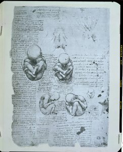 子宫中的五个视图，传真副本 作者 达芬奇（Leonardo da Vinci）