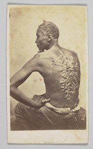 戈登接受医疗检查，1863年。 作者 麦克弗森和奥利弗
