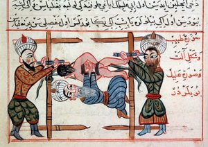 减少骨折。 Sharaf al-din 的土耳其医学疗法的缩影 作者 奥斯曼帝国学校