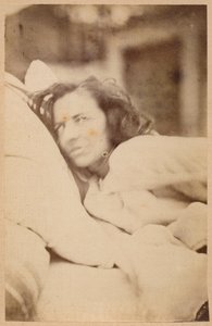 歇斯底里的癫痫，谵妄，欲望，平坦的XXXVI来自Bourneville和P. Regnard的“La Salpetriere摄影图像”，巴黎，1876年（蛋白印刷品）