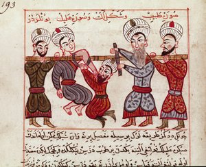 医学：骨科介入。 Charaf-ed-din (Charaf ed Din) (1404-1468) 根据“La Surgery Imperiale”（Sup Turk 女士 693 和 193）1466 巴黎，B.N. 作者 波斯学校
