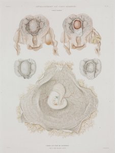 妇科 人体子宫与胚胎，约1847-1859年 作者 理查德（后）爸爸