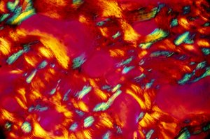 BIO-MATERIALS, LM Bone 作者 不明