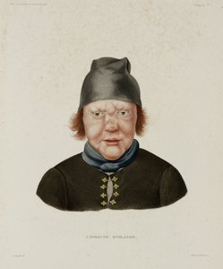 Diseases, Leprosy Female leper, Iceland, early 19th century 作者 不明