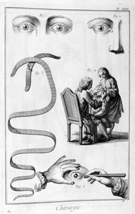眼科手术（1751-1777） 作者 不明