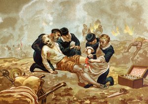 Ambroise Pare Medicin和法国外科医生（约1509-1590）在截肢后练习结扎。巴塞罗那1877年。 作者 未知艺术家
