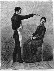 催眠现象：催眠是通过在病人面前突然伸出手来产生的。1881年的雕版画。 作者 未知艺术家