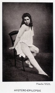 Hystero Epilepsie - “”Salpétrière 的摄影图像中的挛缩：Charcot 先生的服务”，Paul Regnard 和 Bourneville 作者 未知艺术家