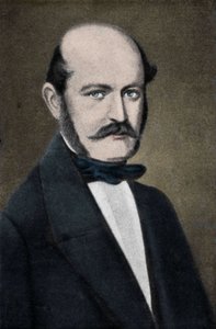 Ignaz Philip Semmelweis (Semmelweiss) 的肖像，匈牙利产科医生 (1818-1865)。 作者 未知艺术家