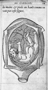 怀孕期间胎儿在子宫中的位置。 16 世纪法国医生兼外科医生 Ambroise Pare（1509-1590）的“De la generation des enfants”雕刻 作者 未知艺术家