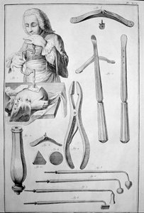 Trepanation of the skull, various instruments (engraving 作者 未知艺术家