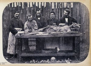 解剖，v.1865。 作者 未知的摄影师