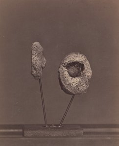 切除的膝关节。右侧股骨内髁有一颗圆形火枪弹[Gardin..., 1866-67.