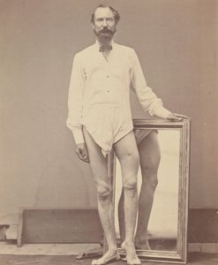 左股骨中三分之一处的枪伤，1865-67年。