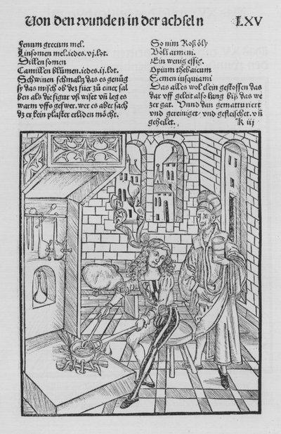 The Book of Cirurgia by Hieronymus Brunschwig (litho) 作者 （之后）德国学校
