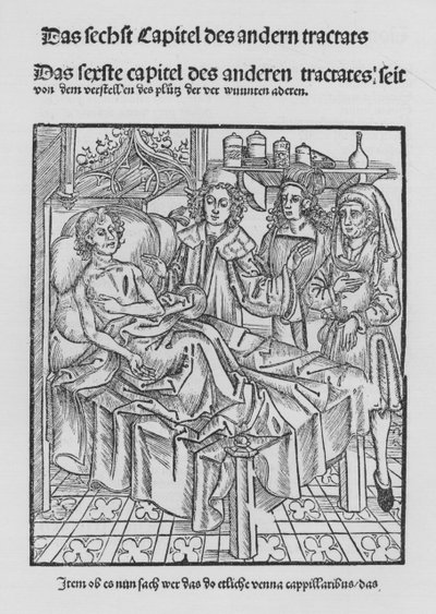 Hieronymus Brunschwig (石版画) 作者 （之后）德国学校