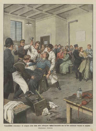 英雄女权主义，英国女权主义者的绝食中断了他们的？ 作者 Achille Beltrame