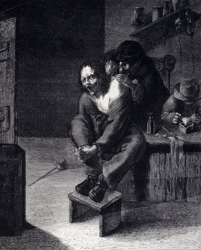 17 世纪阿德里安·布劳威尔 (Adrien Brauwer)（1608 年画）后的外科手术雕刻 作者 Adriaen（之后）Brouwer