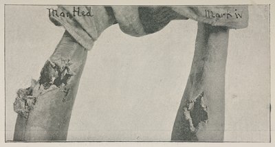 照片选自《和平会议与达姆弹》一文，作者亚历克斯.奥格斯顿，《英国医学杂志》，第 2 卷，第 2013 期（7 月 29 日 作者 英国摄影师
