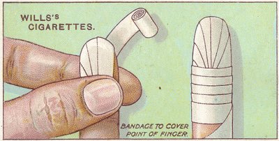 手指绷带，1913年来自Willss Cigarettes卡的急救系列50号 作者 英语学校