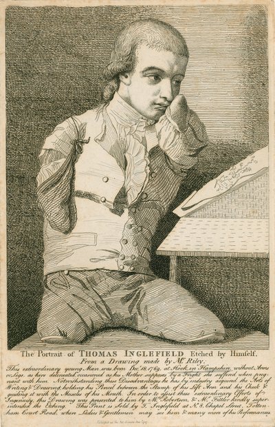 托马斯英格尔菲尔德，1769年12月18日出生于汉普郡的胡克，没有胳膊或腿 作者 英语学校