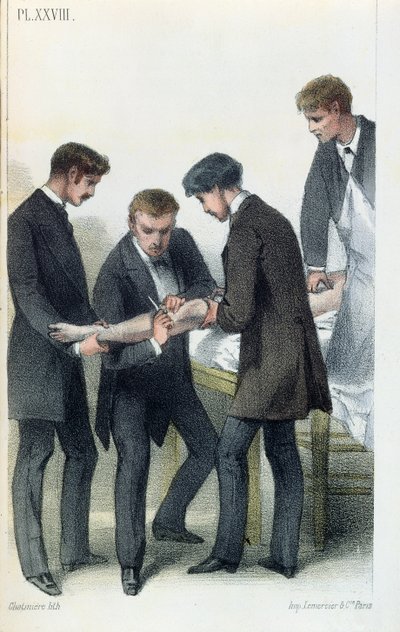 摘自Jean-Baptiste-Leon Dubreuil的医学手册，1850-60 作者 法语学校