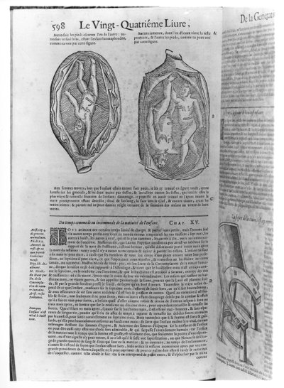 胎儿，插图来自Ambroise Pare的作品（1509-90），于1641年在里昂出版 作者 法语学校