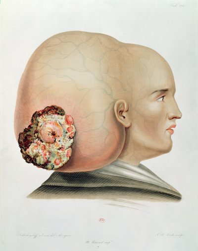硬脑膜的硬脑，来自Selecta Praxis Medico-Chirurgica，Alexander Auvert，巴黎，1856 作者 法语学校