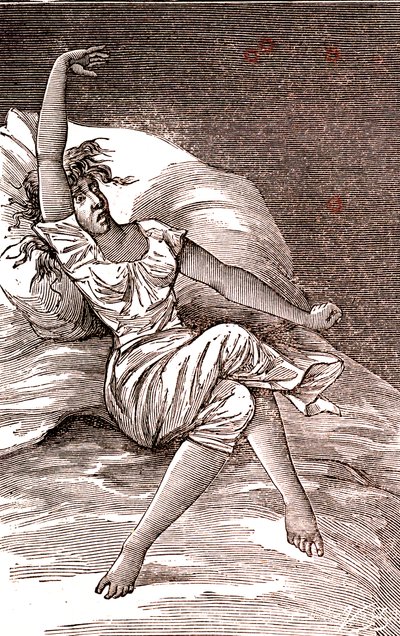 头痛、忧郁、歇斯底里、焦虑。 1887年（雕刻） 作者 法语学校