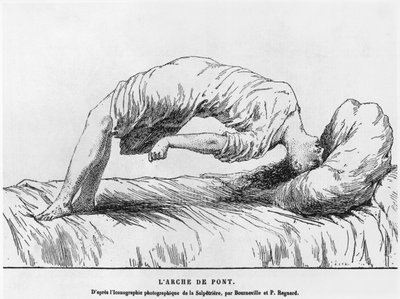 Hysteria和梦游症，来自Les Maladies Epidemiques de lEsprit by Paul Regnard（1850-1927）1884 作者 法语学校