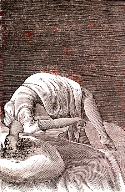 癔病，因强烈焦虑而导致的精神和神经失调。1887年（雕刻） 作者 法语学校