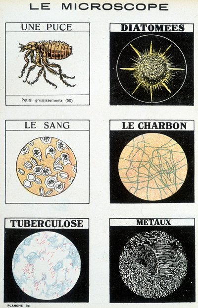显微镜：一个芯片、硅藻、血液、煤炭、结核病、金属。 作者 法语学校