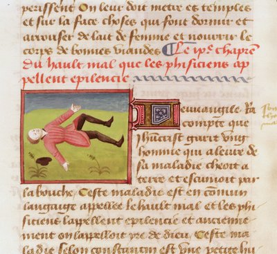 22532名患有癫痫病的患者，来自Barthelemy English的“物联”，c。 1410年至1415年 作者 法语学校